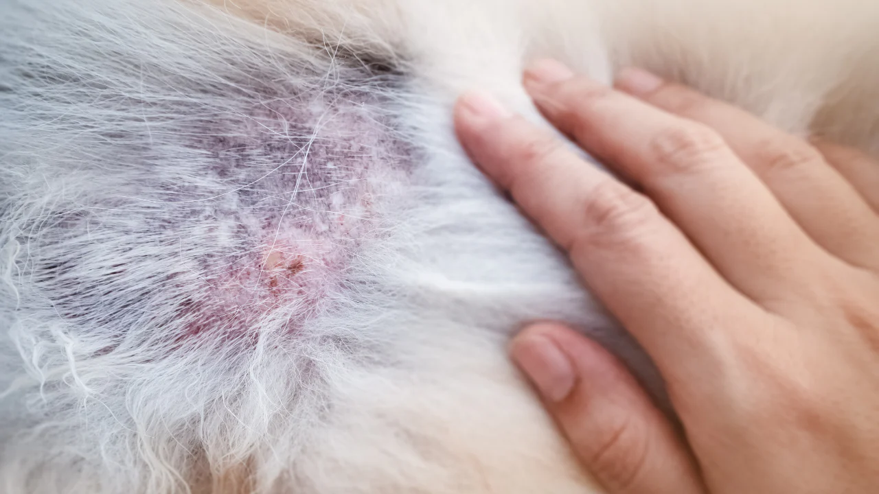 Atopic Dermatitis